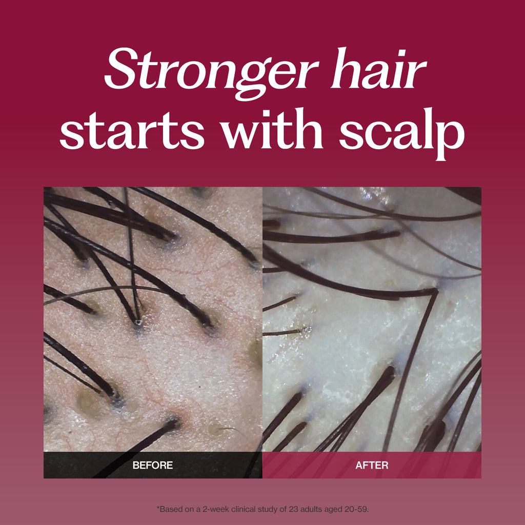 INERTIA Professional Forte Silk Protein Peptide Shampoo